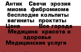 Антик.  Свечи (эрозия, миома, фибромиома, бесплодие,кольпиты, вагиниты, проктиты › Цена ­ 550 - Все города Медицина, красота и здоровье » Медицинские услуги   